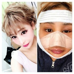 ダレトク歌舞伎町整形キャバ嬢桜井野の花(さくらいののか)の結婚や彼氏は？wikiプロフィール(年齢・大学・スリーサイズ)！N社長の年収や昔や整形前後画像まとめ！【有吉弘行のダレトク】