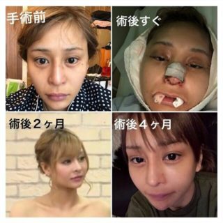 ダレトク歌舞伎町整形キャバ嬢桜井野の花(さくらいののか)の結婚や彼氏は？wikiプロフィール(年齢・大学・スリーサイズ)！N社長の年収や昔や