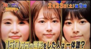 有吉ダマせたら高額整形の鴇嵜希実(ときざきのぞみ)整形箇所や費用や前後画像!wikiプロフィール(経歴・年齢)!結婚や子供は?