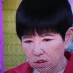 アッコ(和田アキ子)目が変！眼瞼下垂(がんけんかすい)で整形再手術！失敗原因や病院や費用は？